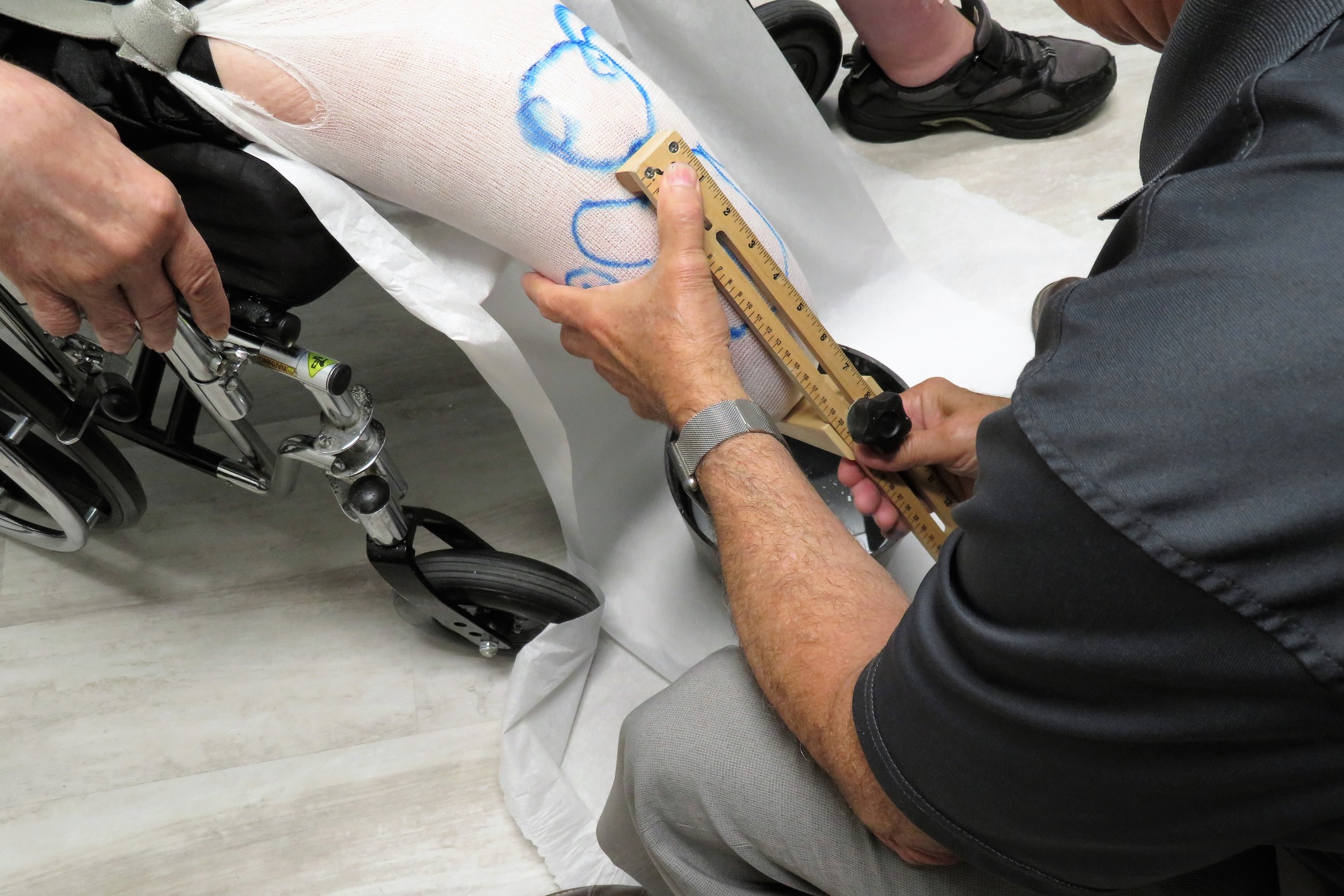 Philadelphia Custom Orthotics and Prosthetics - Komfort & Kare