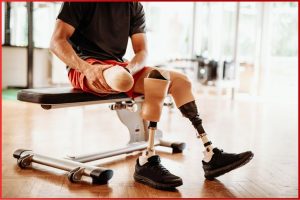 New Jersey Custom Prosthetics Lab